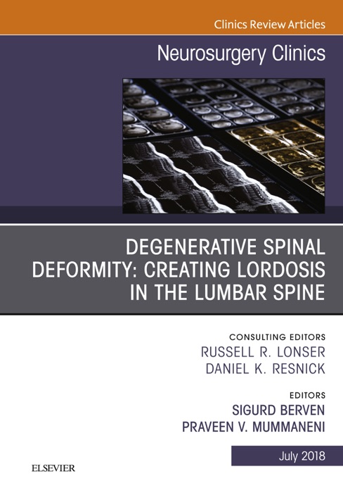 Degenerative Spinal Deformity: Creating Lordosis in the Lumbar Spine, An Issue of Neurosurgery Clinics of North America E-Book