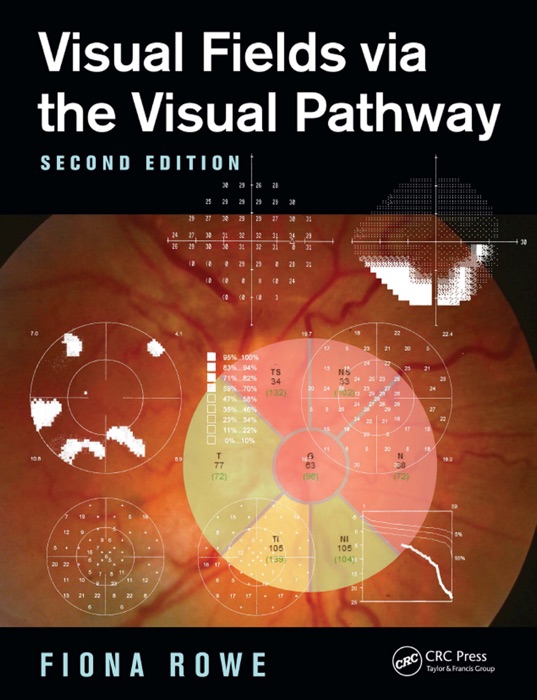 Visual Fields via the Visual Pathway