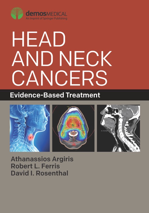 Head and Neck Cancers