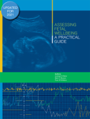 Assessing Fetal Wellbeing: A Practical Guide - Lesleigh S Baker