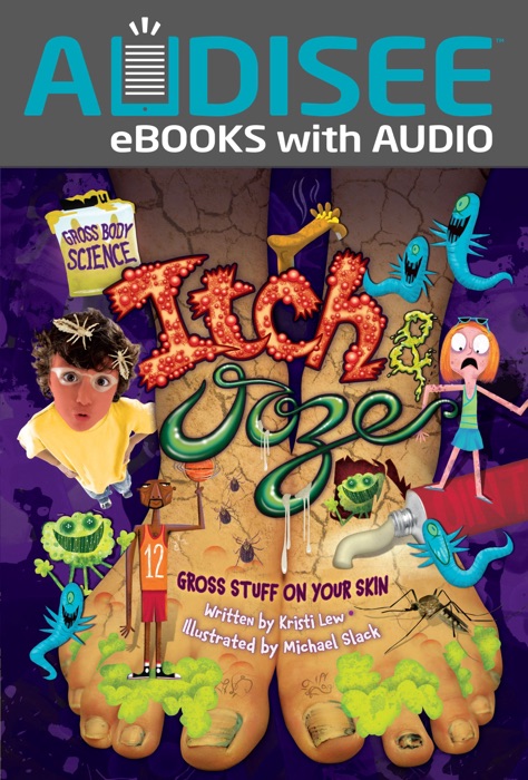 Itch & Ooze (Enhanced Edition)