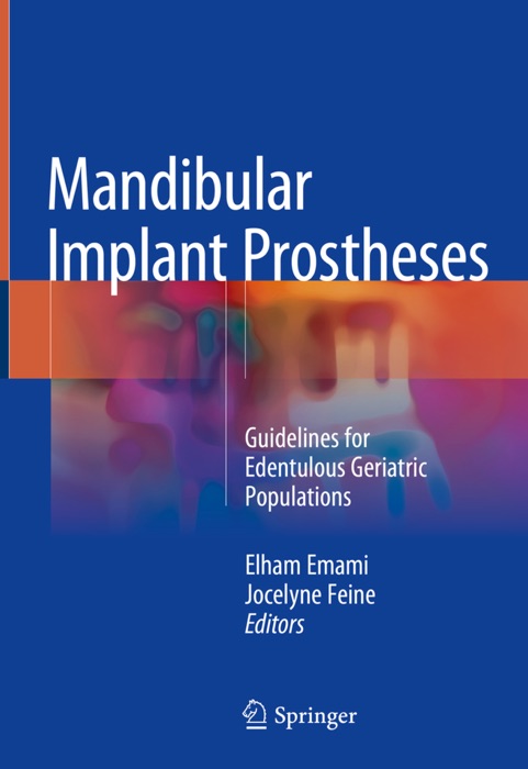 Mandibular Implant Prostheses