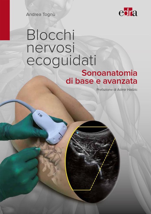 Blocchi nervosi ecoguidati