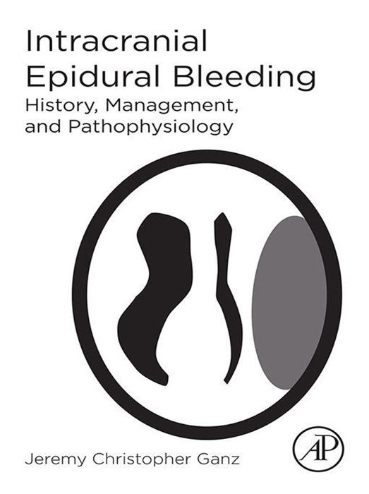 Intracranial Epidural Bleeding