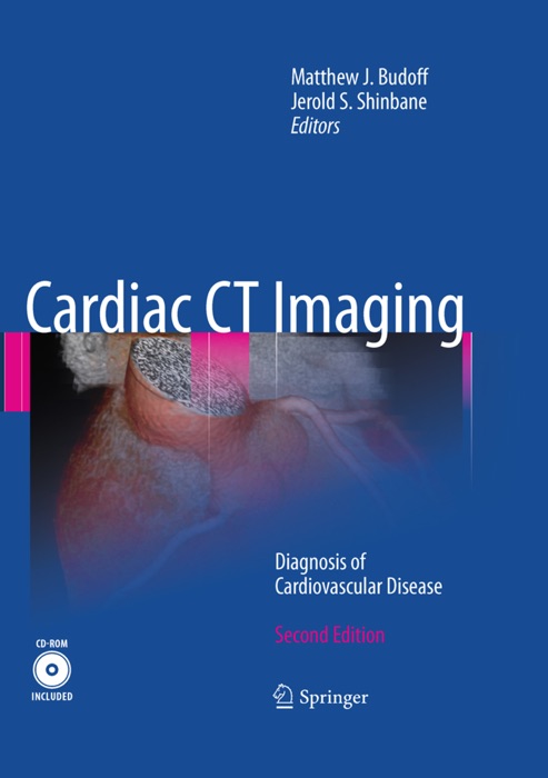 Cardiac CT Imaging