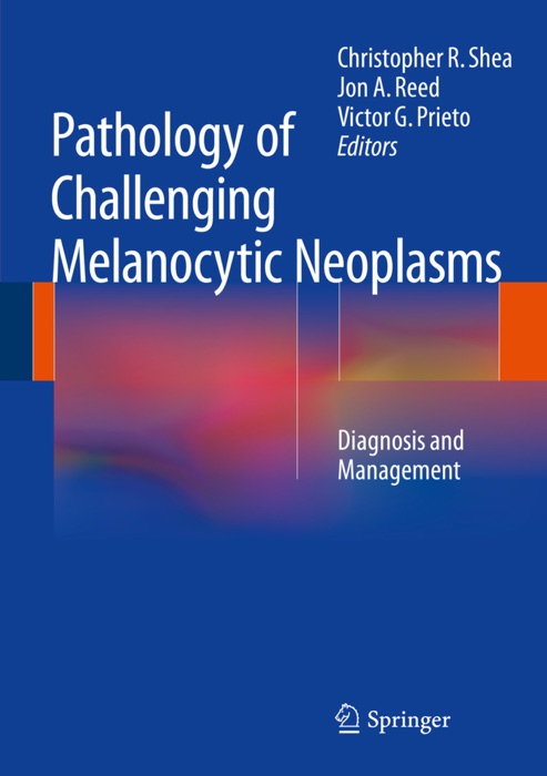 Pathology of Challenging Melanocytic Neoplasms