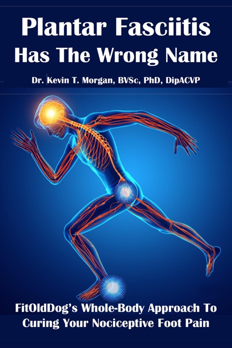 Plantar Fasciitis Has The Wrong Name