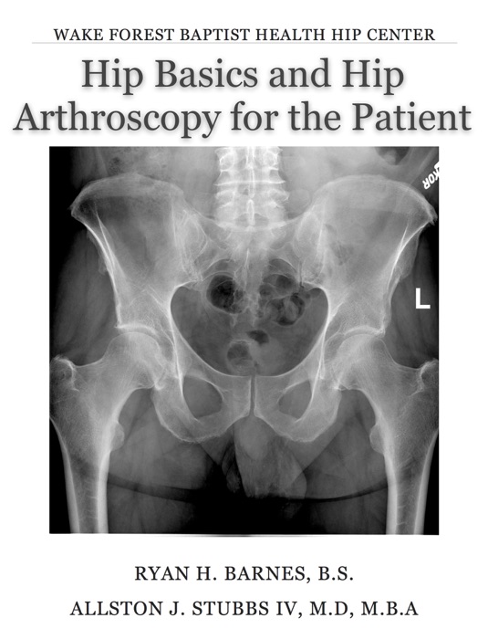 Hip Basics and Hip Arthroscopy for the Patient