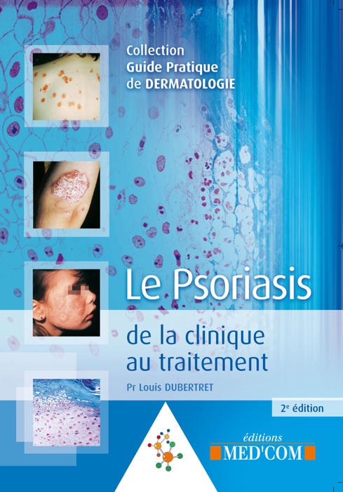 Le psoriasis