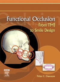 Functional Occlusion - E-Book