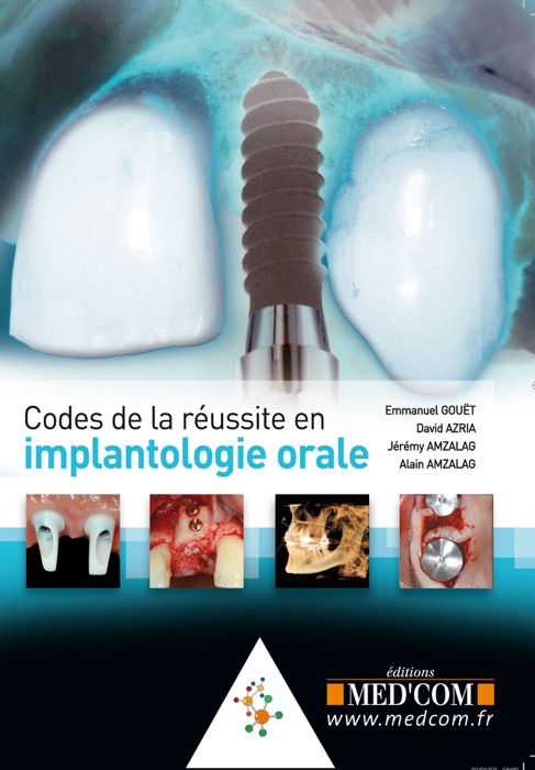 Codes de la réussite en implantologie orale