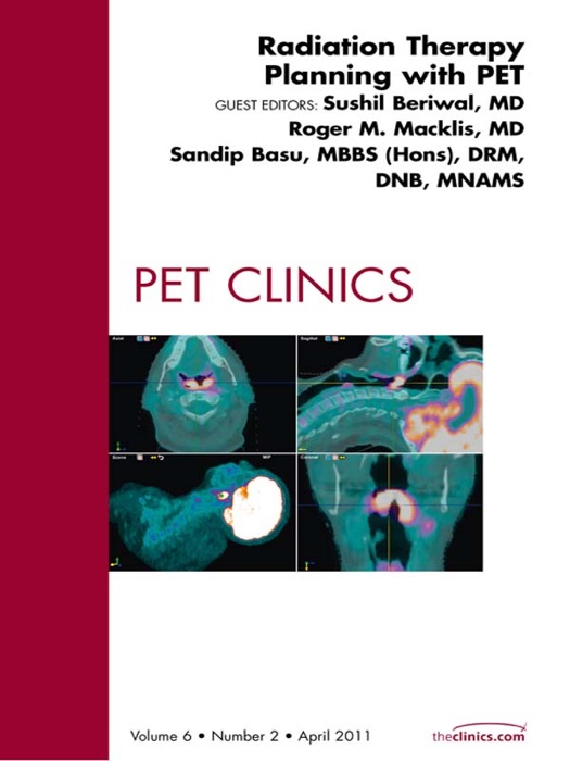 Radiation Therapy Planning, An Issue of PET Clinics - E-Book