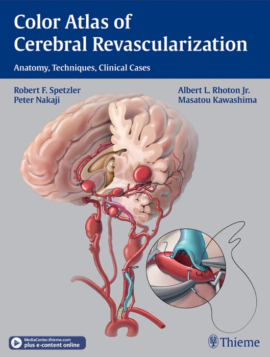 Color Atlas of Cerebral Revascularization: Anatomy, Techniques, Clinical Cases