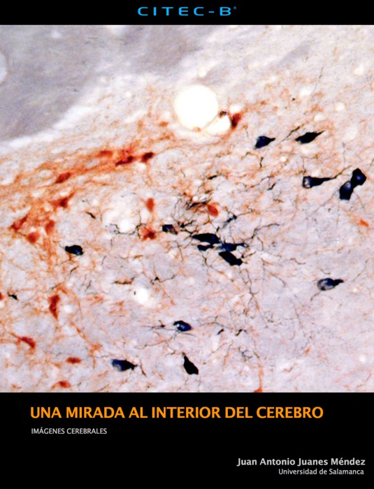 Una mirada al interior del cerebro