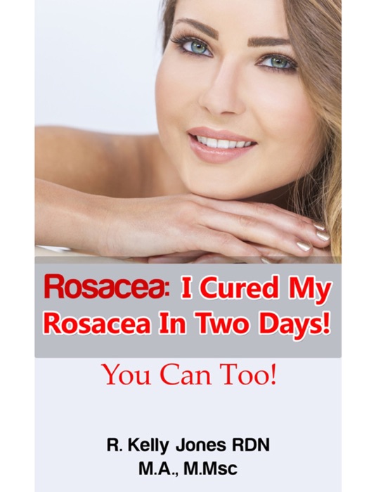 Rosacea I Cured My Rosacea In Two Days You Can Too