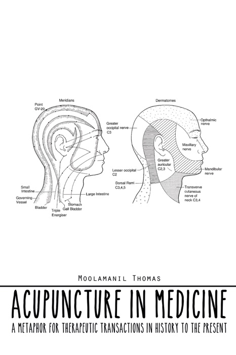 Acupuncture in Medicine