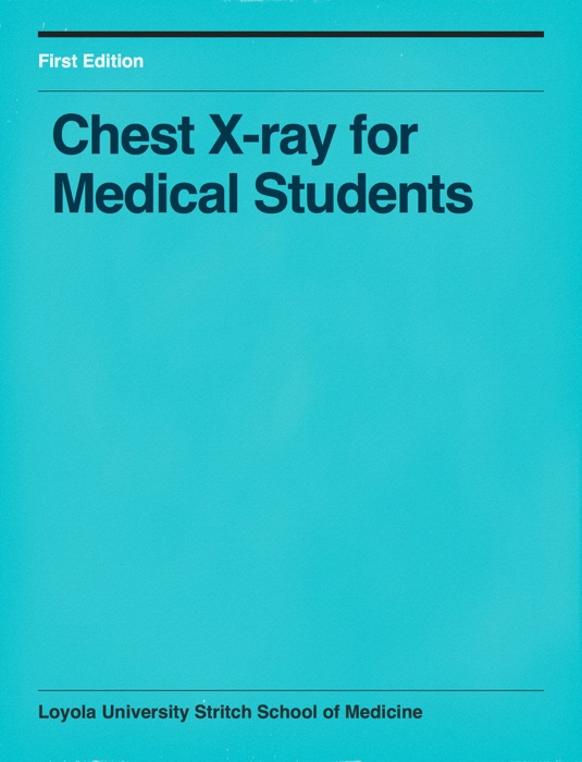 Chest X-Ray for Medical Students