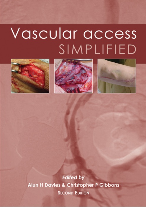 Vascular Access Simplified, 2nd Edition