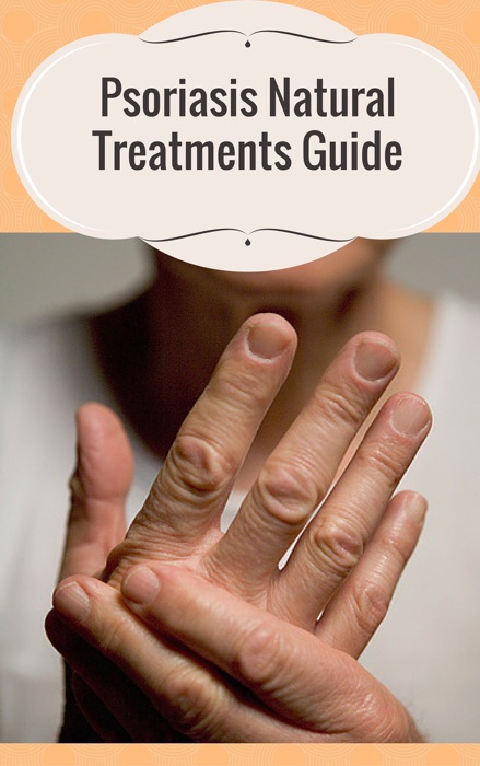 Psoriasis Natural Treatments Guide