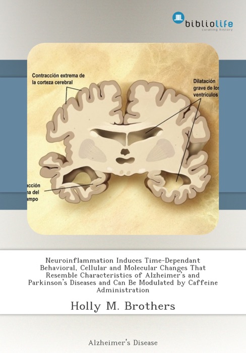 Neuroinflammation Induces Time-Dependant Behavioral, Cellular and Molecular Changes That Resemble Characteristics of Alzheimer’s and Parkinson’s Diseases and Can Be Modulated by Caffeine Administration
