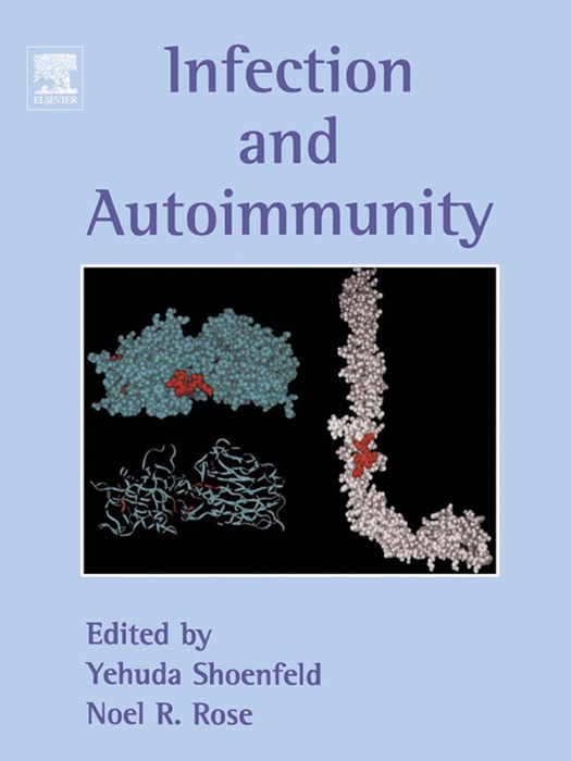 Infection and Autoimmunity (Enhanced Edition)