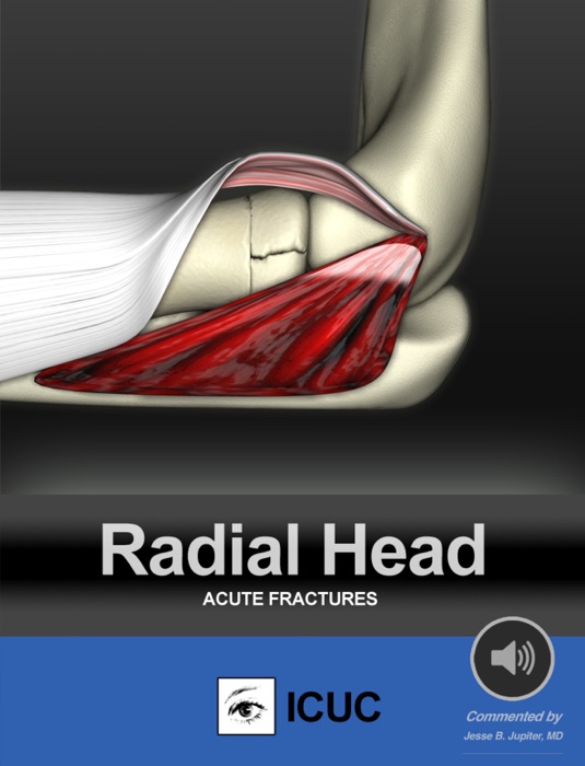 Radial Head