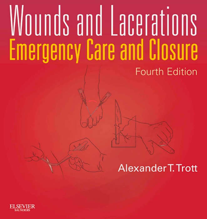 Wounds and Lacerations