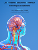 Les Accidents Vasculaires cérébraux Ischémiques Carotidiens - Nicolas Bronsard