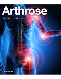 Book's Cover of L'Arthrose