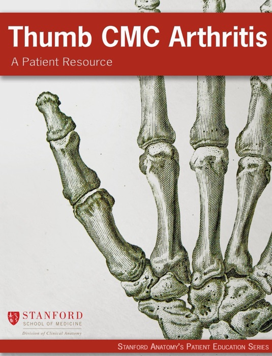 Thumb CMC Arthritis