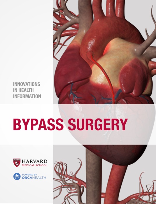 Bypass Surgery