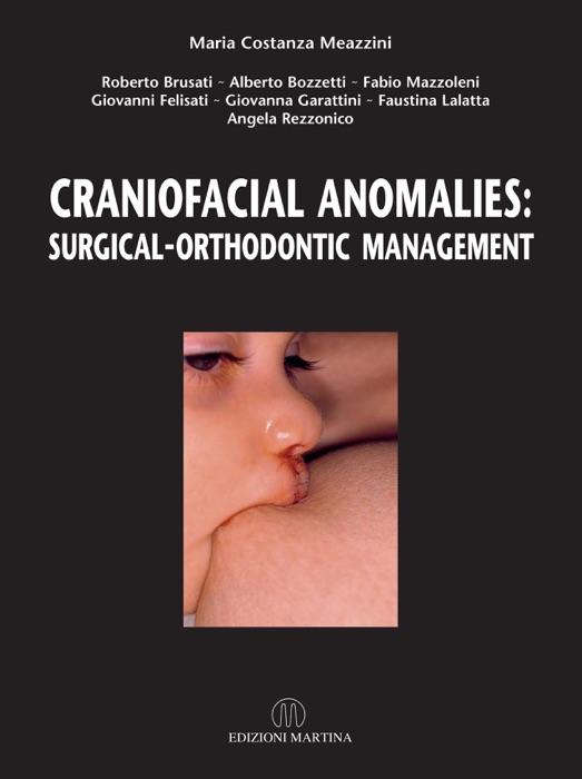 Craniofacial Anomalies: