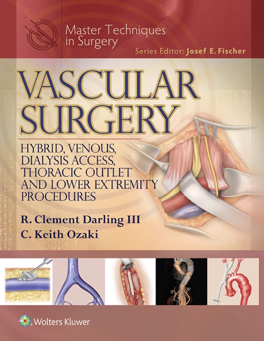 Vascular Surgery: Hybrid, Venous, Dialysis Access, Thoracic Outlet, and Lower Extremeity Procedures