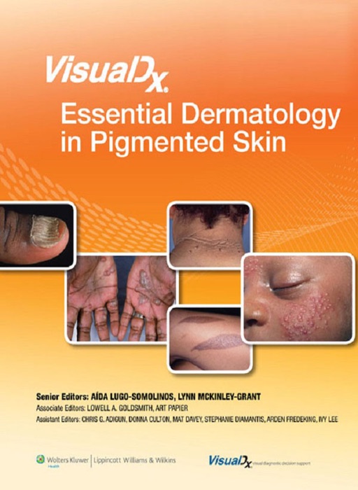 VisualDx: Essential Dermatology in Pigmented Skin