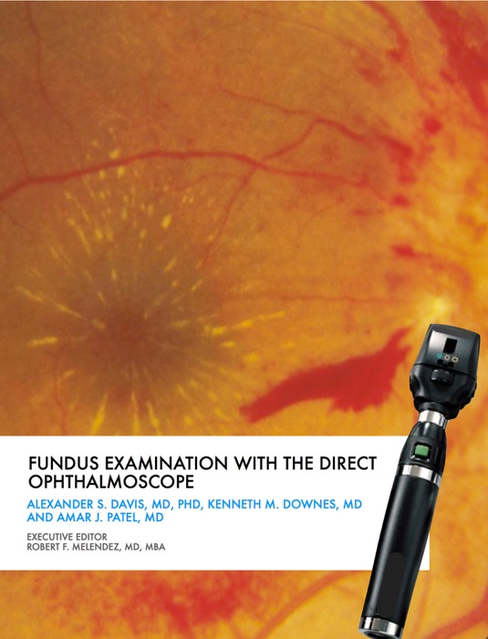 Fundus Examination with the Direct Ophthalmoscope