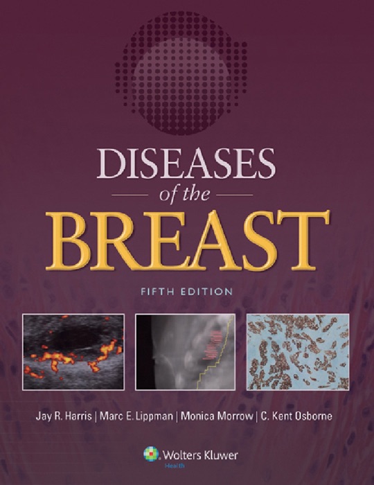 Diseases of the Breast: Fifth Edition