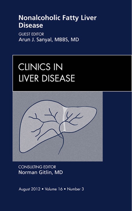 Nonalcoholic Fatty Liver Disease, An Issue of Clinics in Liver Disease - E-Book