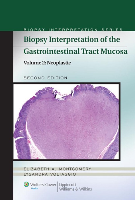 Biopsy Interpretation of the Gastrointestinal Tract Mucosa: Volume 2: Neoplastic, Second Edition