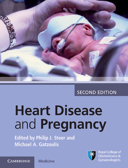 Heart Disease and Pregnancy: Second Edition