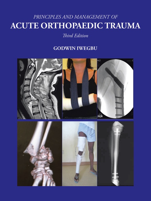 Principles and Management of Acute Orthopaedic Trauma