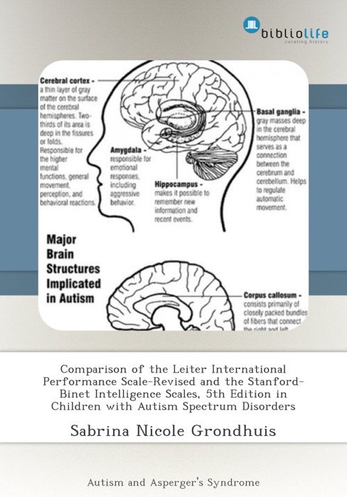 Comparison of the Leiter International Performance Scale-Revised and the Stanford-Binet Intelligence Scales, 5th Edition in Children with Autism Spectrum Disorders