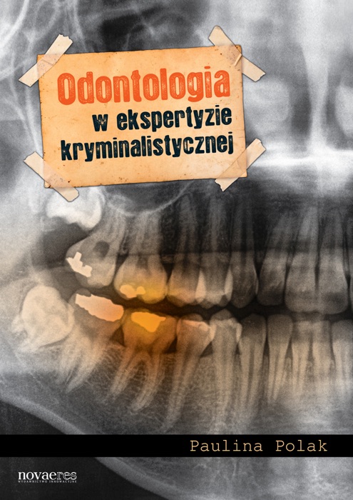 Odontologia w ekspertyzie kryminalistycznej