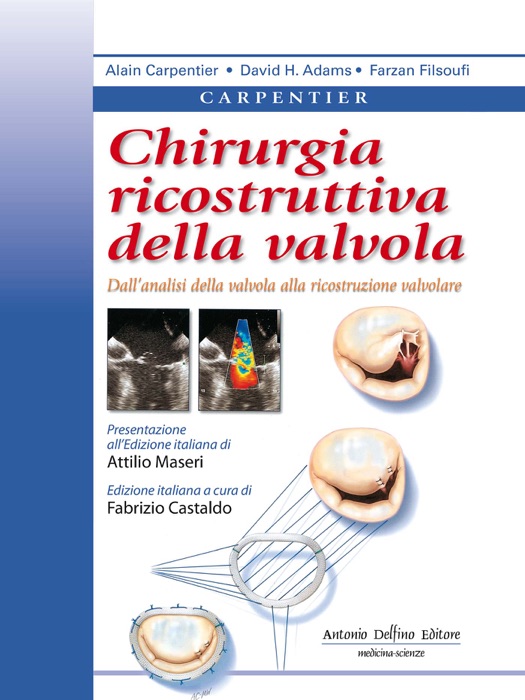 Chirurgia ricostruttiva della valvola