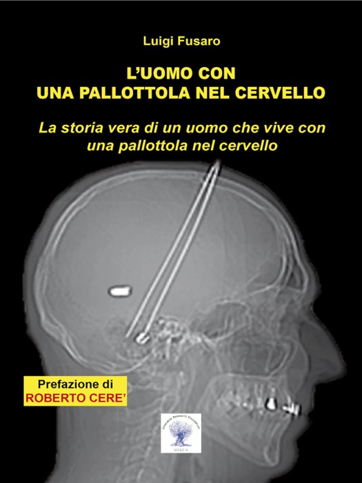 L’uomo con una pallottola nel cervello