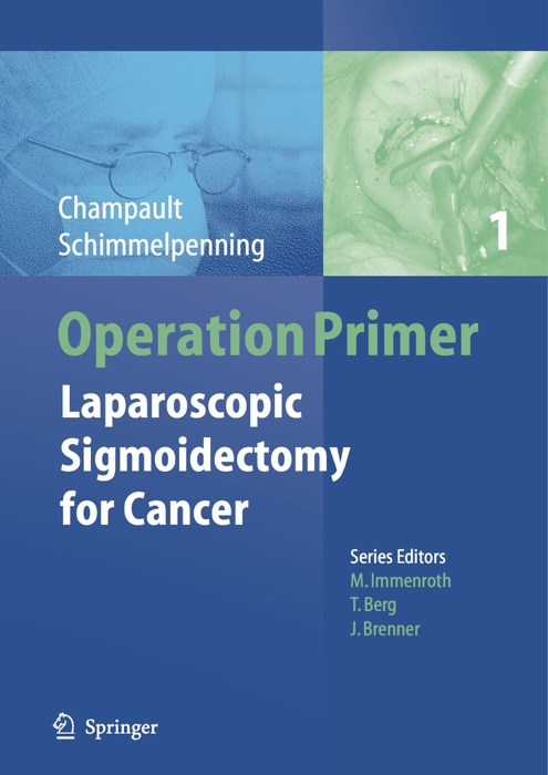 Operation Primer – Laparoscopic Sigmoidectomy for Cancer