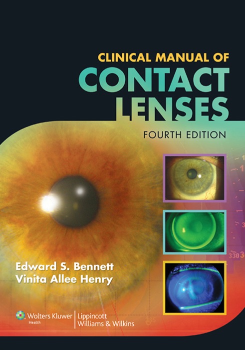 Clinical Manual of Contact Lenses: Fourth Edition