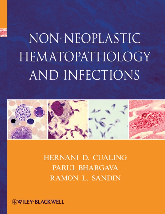 Non-Neoplastic Hematopathology and Infections