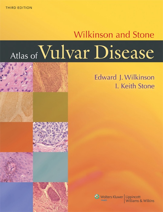 Wilkinson and Stone Atlas of Vulvar Disease: Third Edition