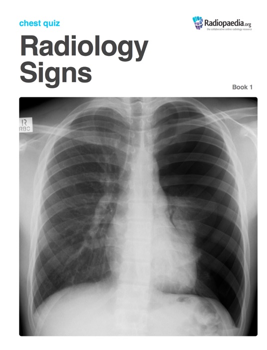 Radiology Signs Chest Quiz - Book 1