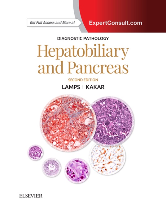 Diagnostic Pathology: Hepatobiliary and Pancreas E-Book